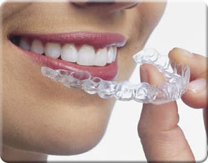 Invisible braces for teens and adults