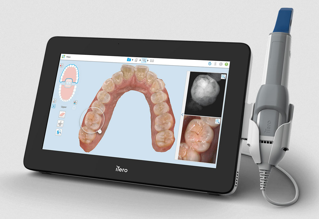 iTero Scanner